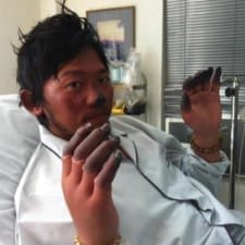 Nobukazu Kuriki in Kathmandu Hospital (courtesy of Nobukazu Kuriki)