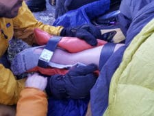 Alan Broken leg picture with splint