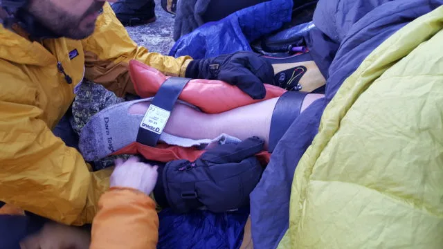 Alan Broken leg picture with splint